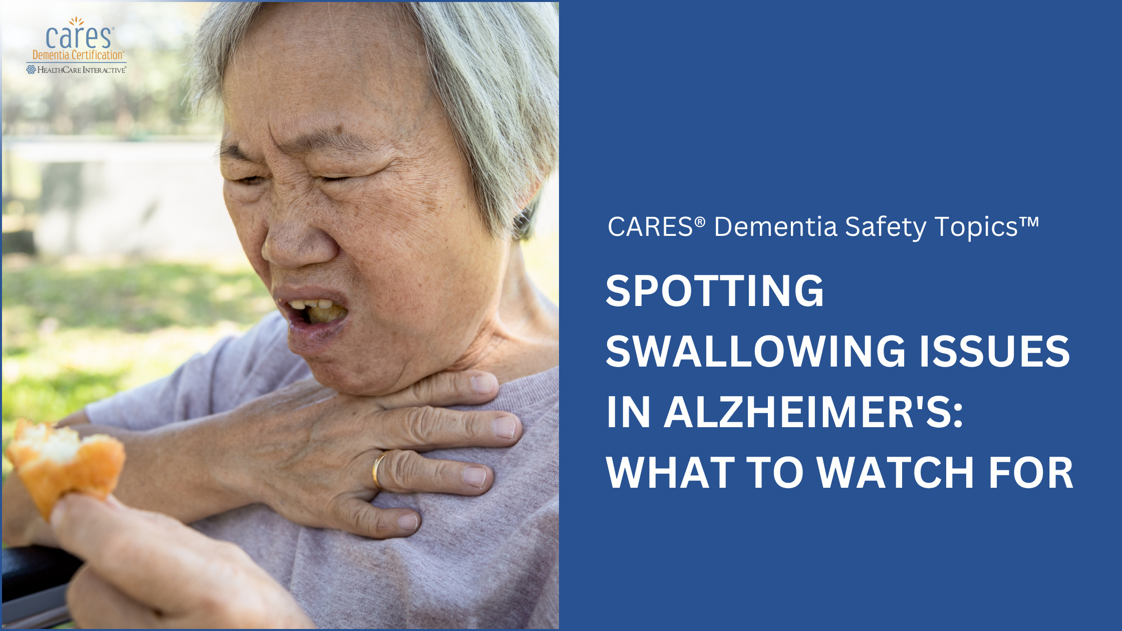 Recognizing the Warning Signs of a Swallowing Problem in Alzheimer’s Disease